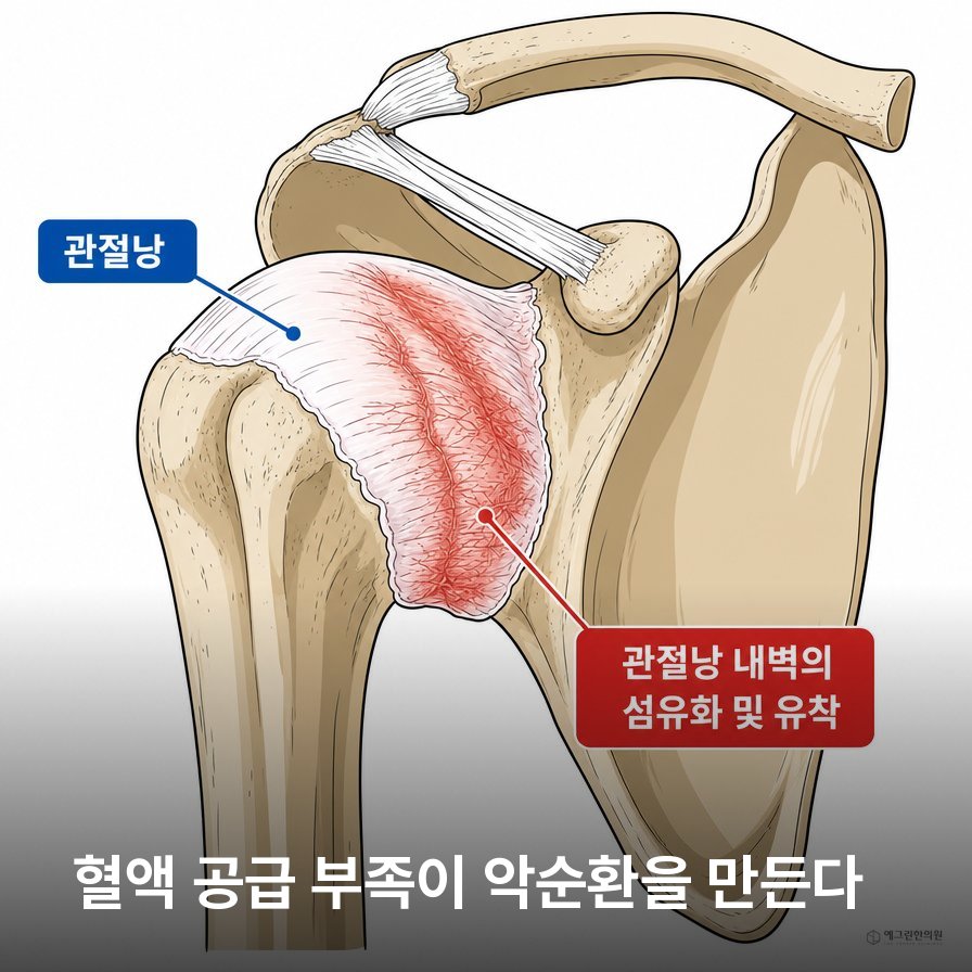 오십견 팔이 올라가지 않는 어깨 가동범위 제한