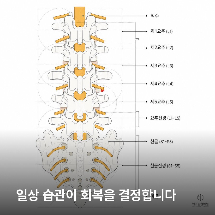 허리디스크 일상생활 관리 방법
